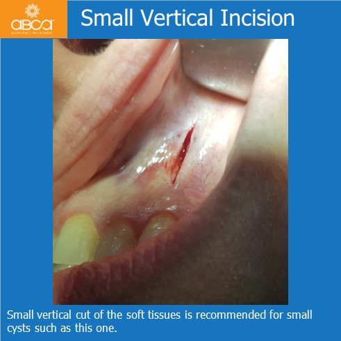 Clinical Case