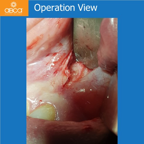 Clinical Case