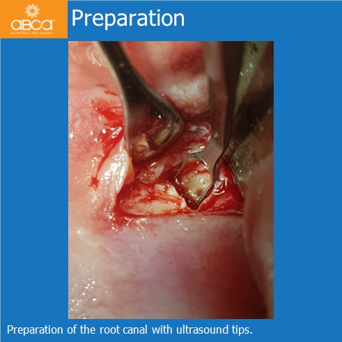 Clinical Case