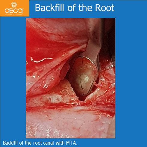 Clinical Case