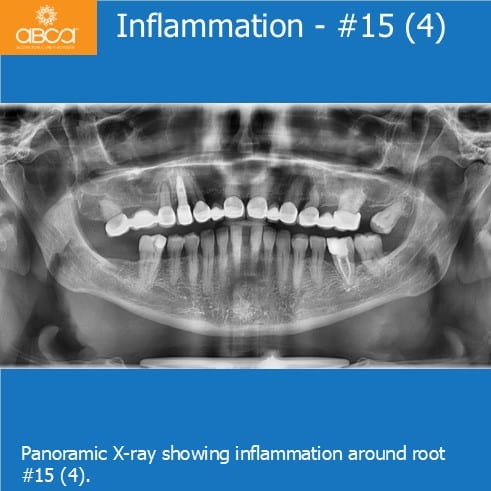 Clinical Case