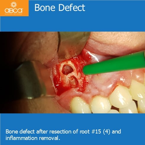Clinical Case