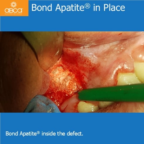 Clinical Case