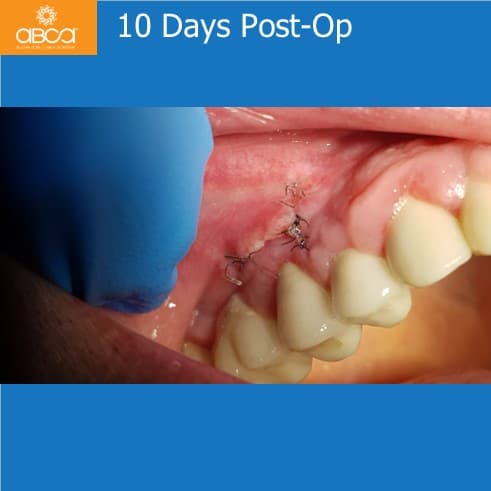 Clinical Case