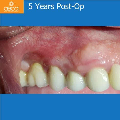 Clinical Case