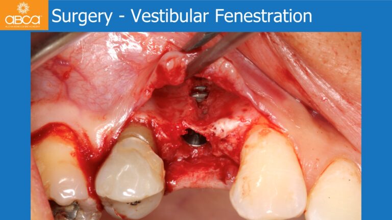 Clinical Case