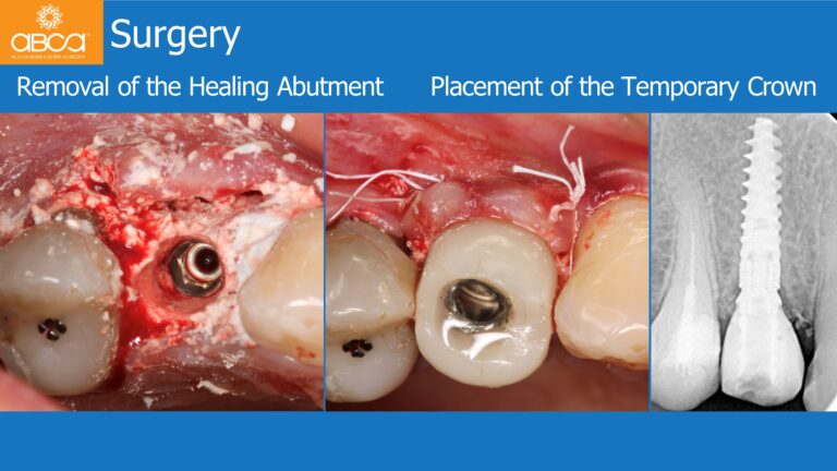 Clinical Case