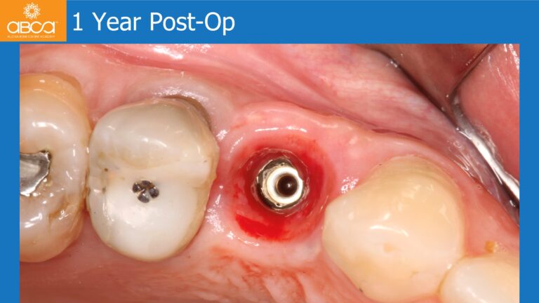 Clinical Case