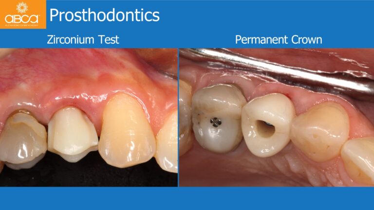 Clinical Case