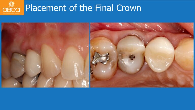 Clinical Case