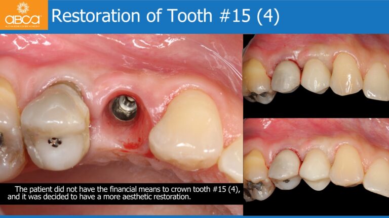 Clinical Case