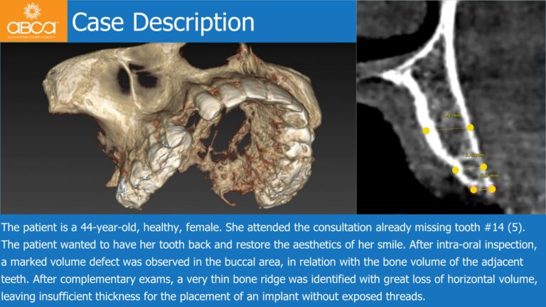 Clinical Case