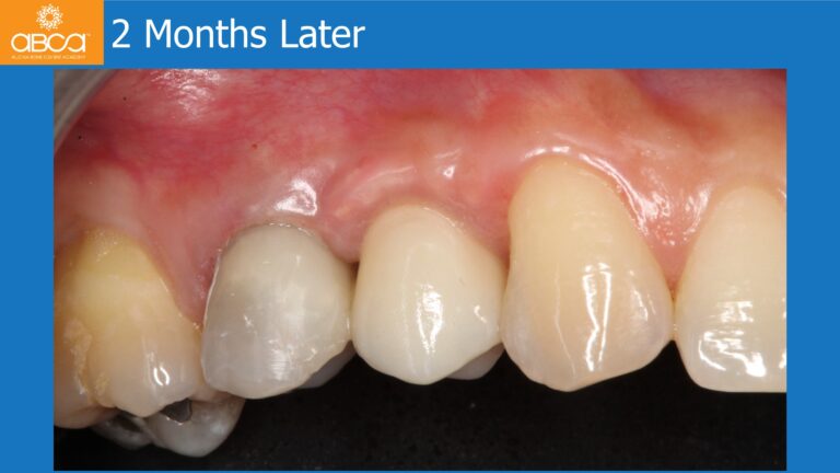 Clinical Case