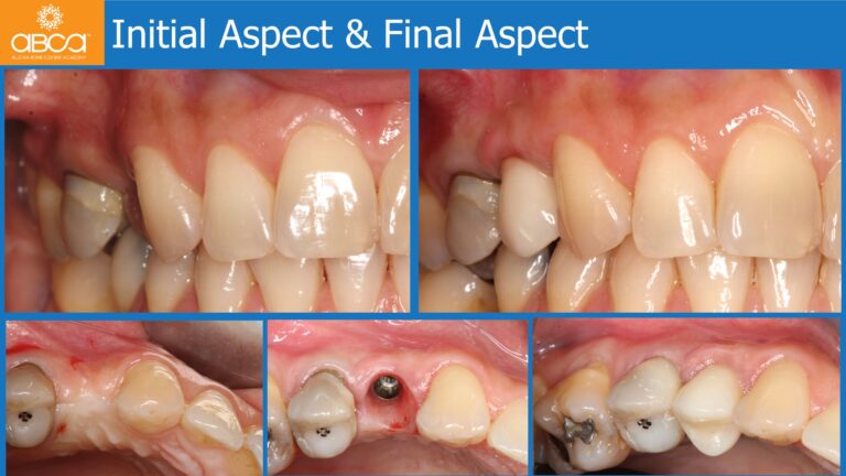 Clinical Case