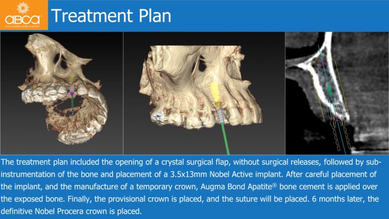 Clinical Case