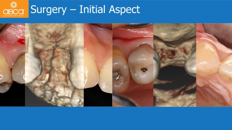 Clinical Case