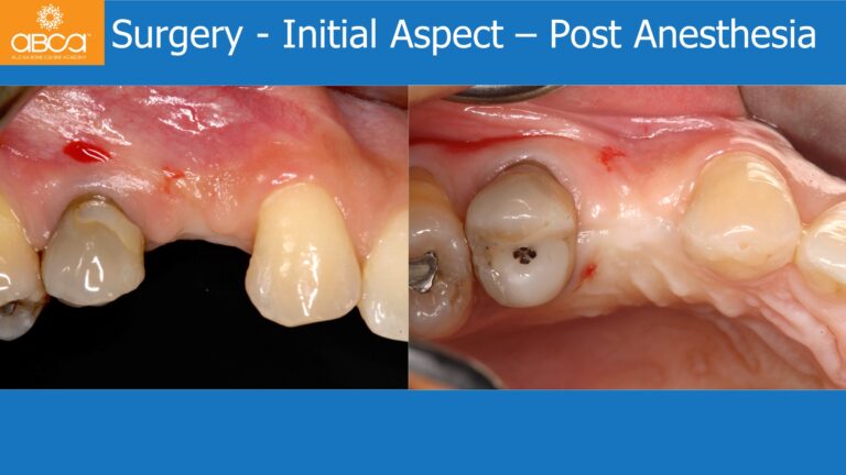 Clinical Case