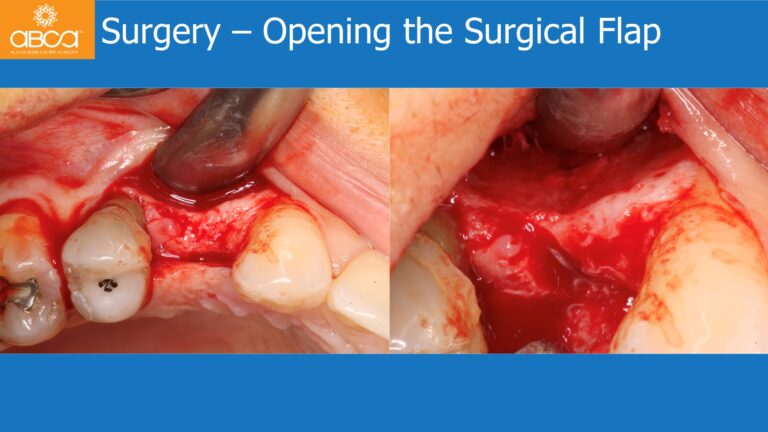 Clinical Case