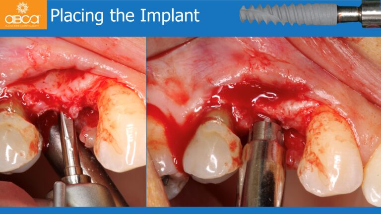 Clinical Case