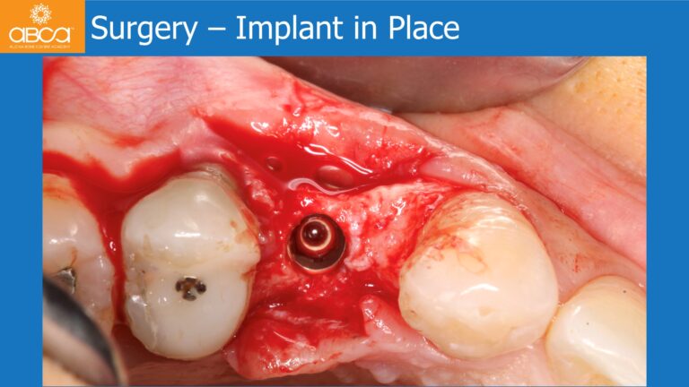 Clinical Case