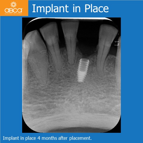 Clinical Case