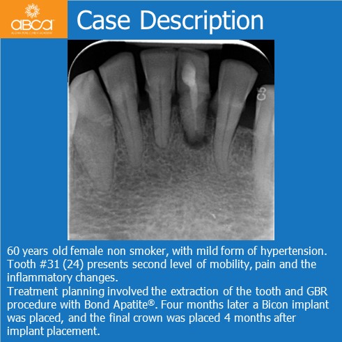 Clinical Case