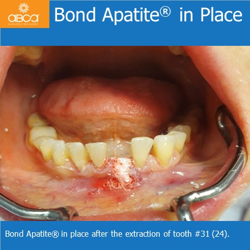 Clinical Case