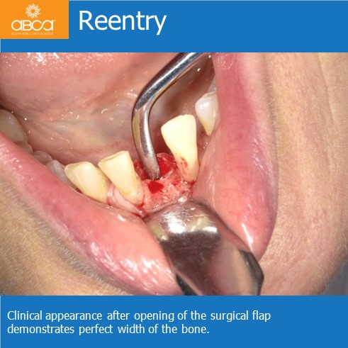 Clinical Case