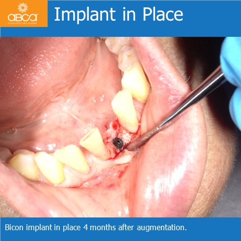 Clinical Case