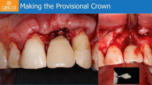 Making the Provisional Crown