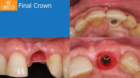 Final Crown
