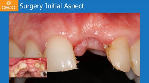 Surgery Initial Aspect