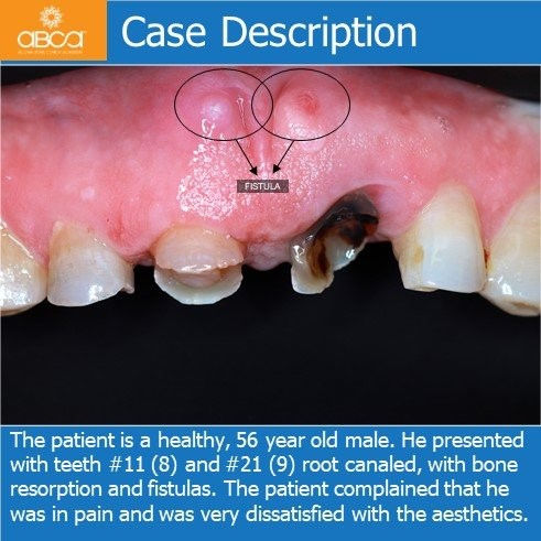 Case Description