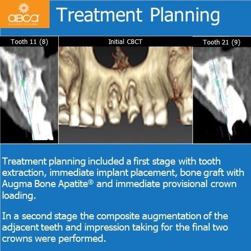 Treatment Planning