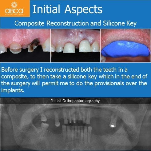 Initial Aspects