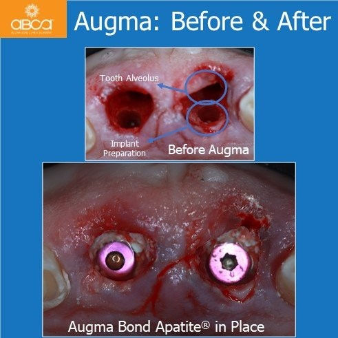 Augma: Before & After