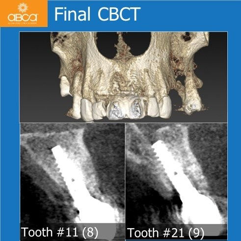 Final CBCT