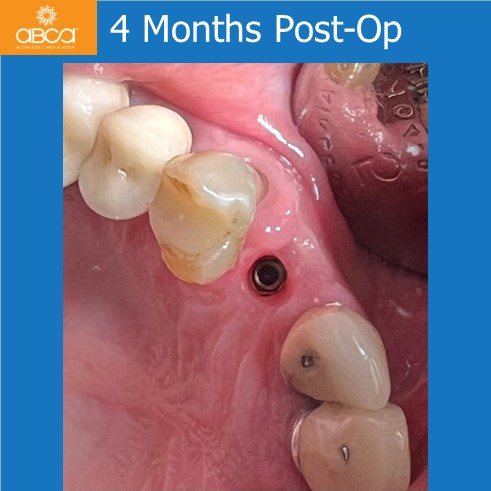 Clinical Case