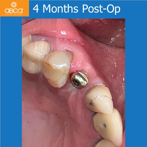 Clinical Case
