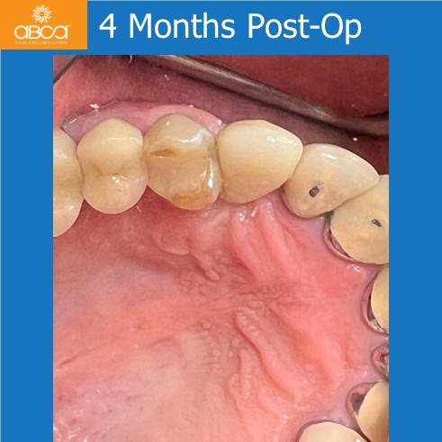 Clinical Case