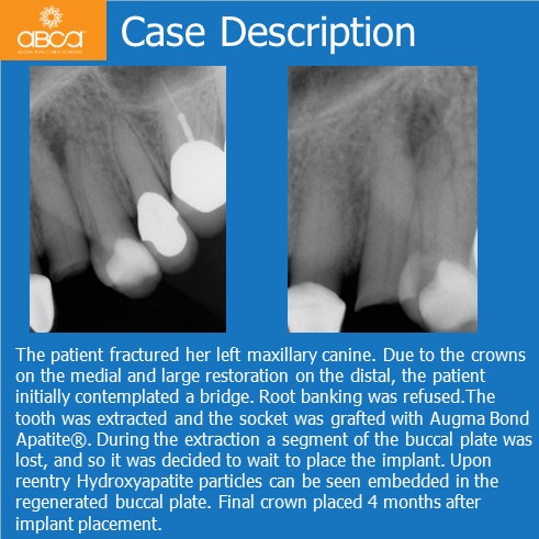 Clinical Case