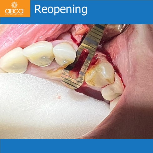 Clinical Case