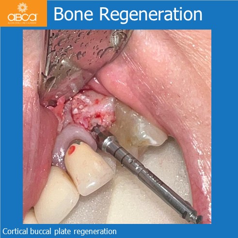 Clinical Case