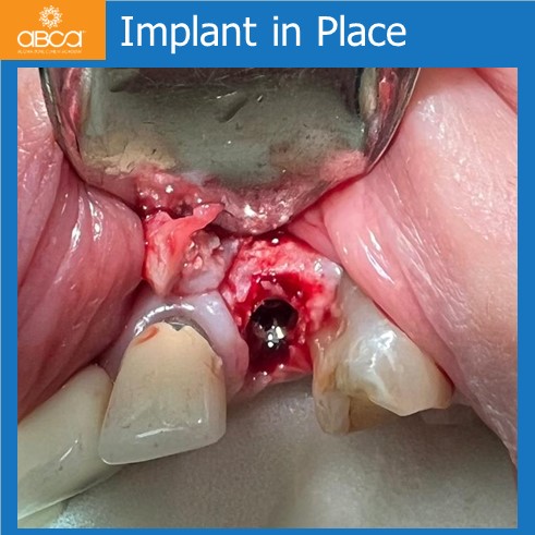 Clinical Case