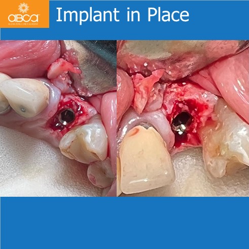 Clinical Case