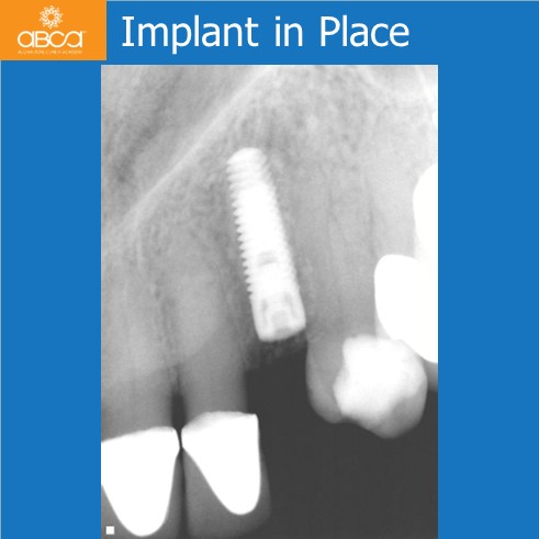 Clinical Case