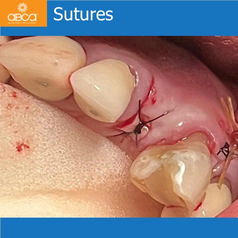 Clinical Case