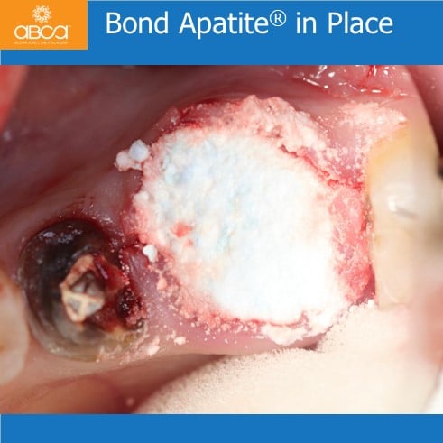 Clinical Case