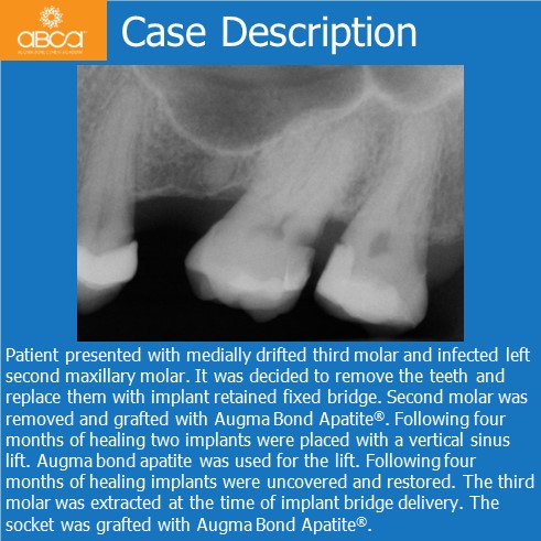 Clinical Case