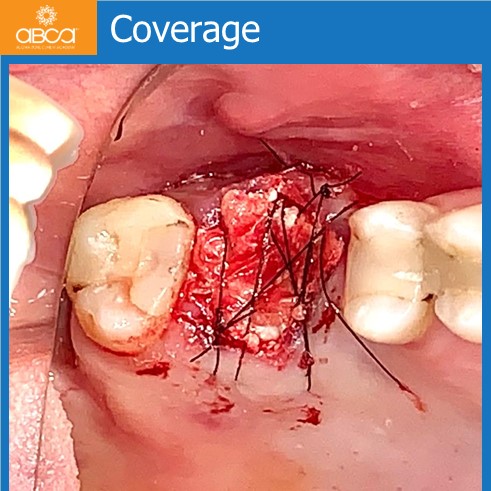 Clinical Case